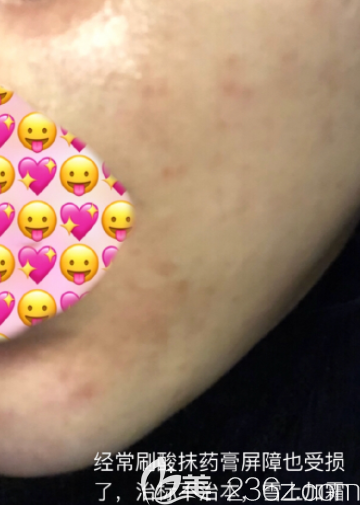 20190731_1564562727267486.png image.png