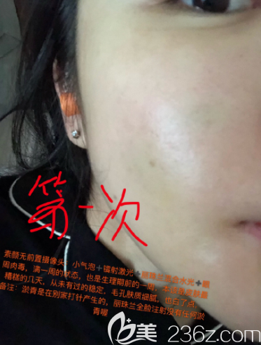 20190731_1564562768804205.png image.png