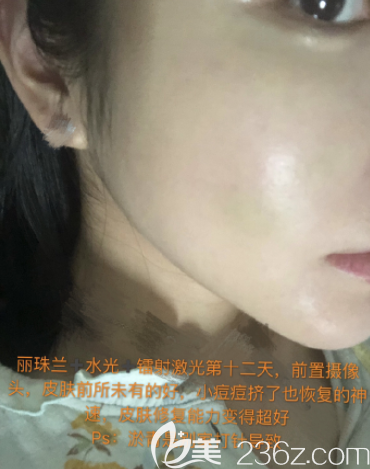 20190731_1564562791395816.png image.png