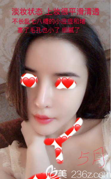 韓國蕾切爾皮膚管理怎么樣 韓國蕾切爾皮膚管理怎么樣