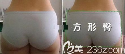 媽媽臀是什么樣子