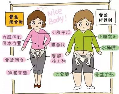 產(chǎn)后女性出現(xiàn)媽媽臀原因