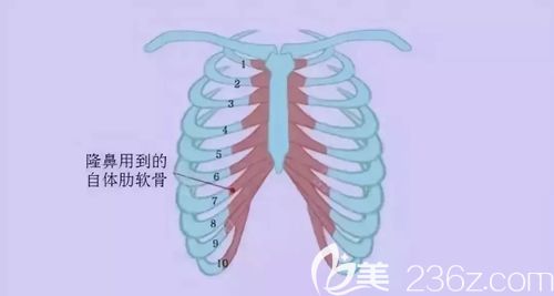 肋軟骨取出位置介紹