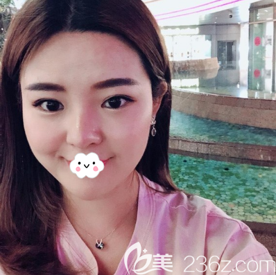 成都艾米麗潘紅偉打瘦臉20天 成都艾米麗潘紅偉打瘦臉20天