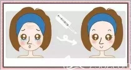 注射玻尿酸除皺效果怎么樣？好不好？