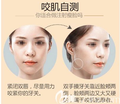 自測是否是咬肌肥大