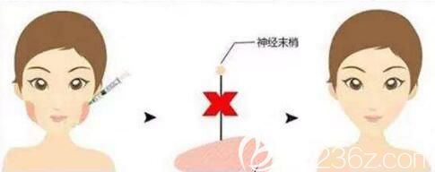 注射完瘦臉需要注意事項(xiàng)