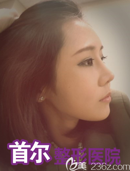 韓國首爾整形做鼻子怎么樣 韓國首爾整形做鼻子怎么樣