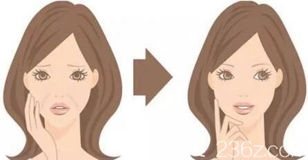 面部線雕提升消除法令紋