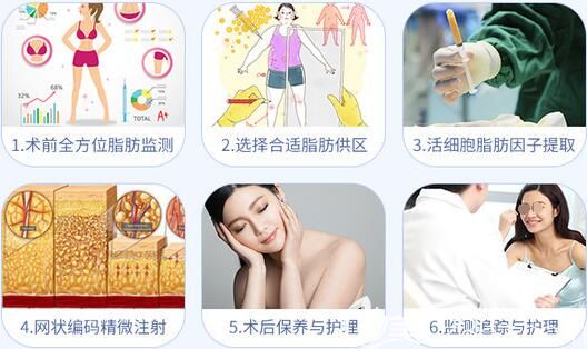 自體脂肪面部填充術(shù)的步驟