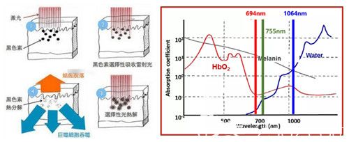 紅寶石點(diǎn)陣激光祛黃褐斑原理