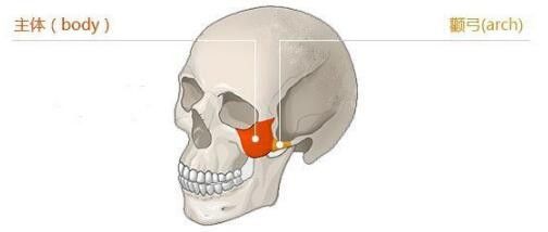 顴骨內(nèi)推手術(shù)