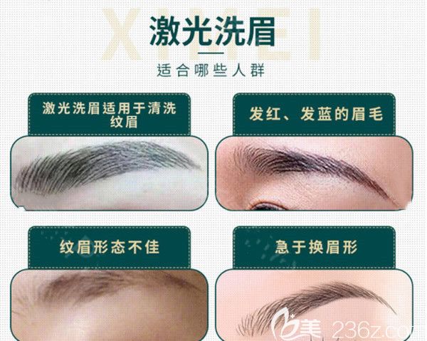 激光洗眉適合哪些人