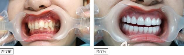 廣州曙光矯正牙齒怎么樣