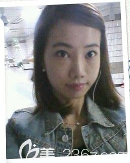 脂肪移植 那木整形 脂肪移植 那木整形