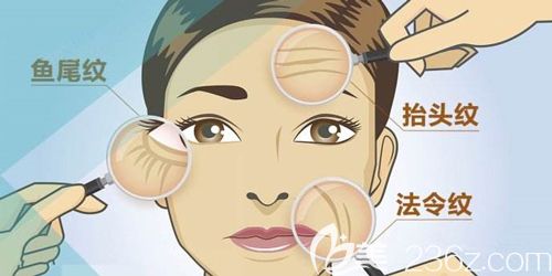 面部容易出現(xiàn)皺紋的部位