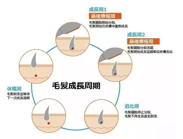 激光脫腋毛支隊(duì)生長(zhǎng)期的毛發(fā)有效果