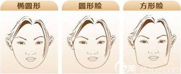 什么樣的臉型適合做下頜角手術(shù) 什么樣的臉型適合做下頜角手術(shù)