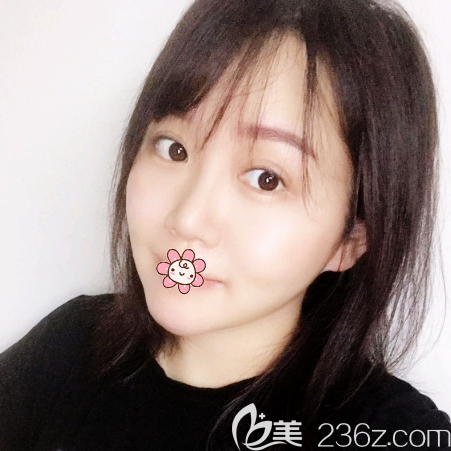 廣州軍美王娜做吸脂怎么樣 廣州軍美王娜做吸脂怎么樣