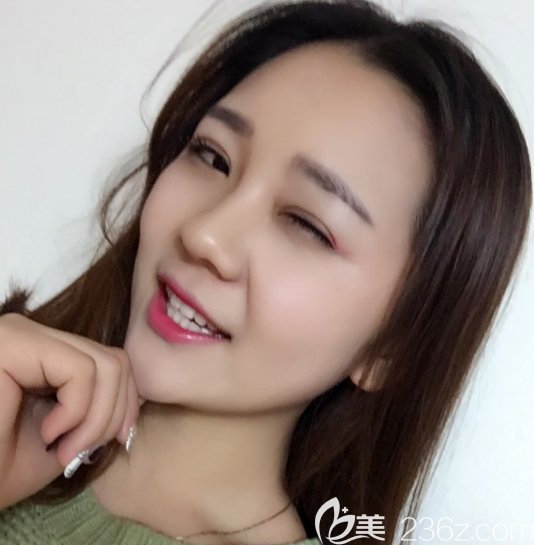 韓國奧斯卡 做眼睛怎么樣