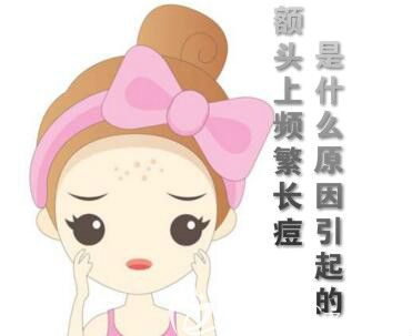 額頭上頻繁長痘的原因