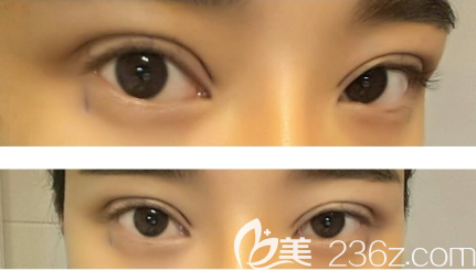 20190807_1565164894738715.png image.png