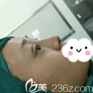 剛做完翹睫美瞳術(shù)和<span style=