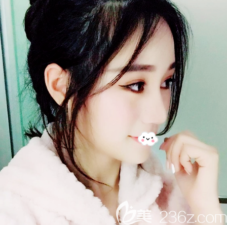 廣州軍美王世虎做面部吸脂術(shù)后兩周消腫 廣州軍美王世虎做面部吸脂術(shù)后兩周消腫