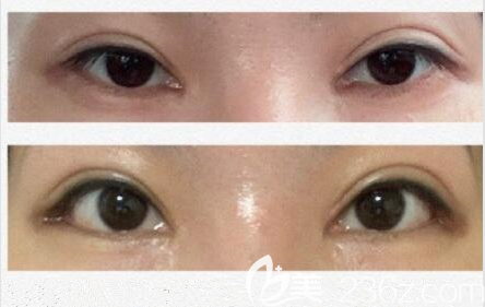 韓國(guó)Gio車知?jiǎng)淄庋劢? alt=