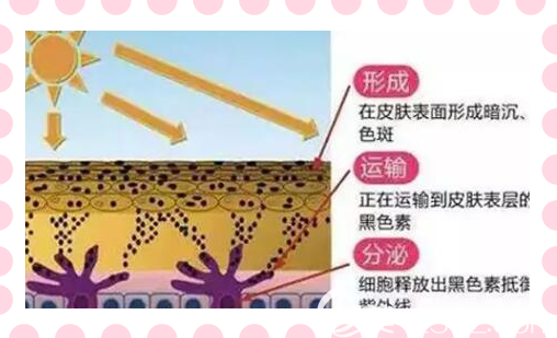 激光祛斑后防曬