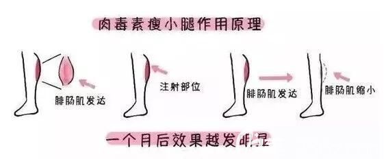 瘦腿原理