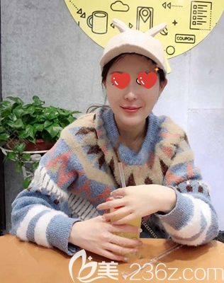 南陽維多利亞自體脂肪面部填充術(shù)后45天 南陽維多利亞自體脂肪面部填充術(shù)后45天