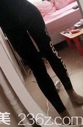 365mc大腿吸脂真人案例 365mc大腿吸脂真人案例