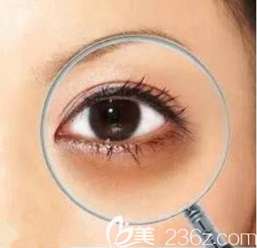 黑眼圈影響眼部美觀