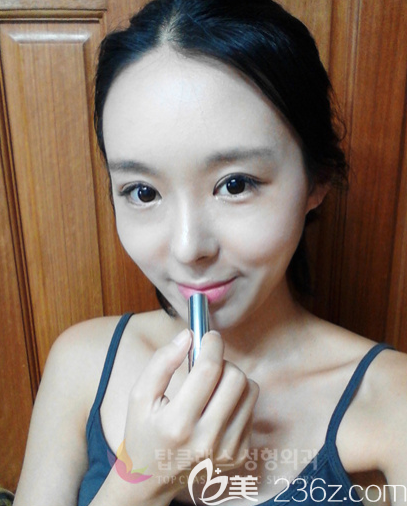 韓國TOPCLASS立體輪廓鼻真人案例