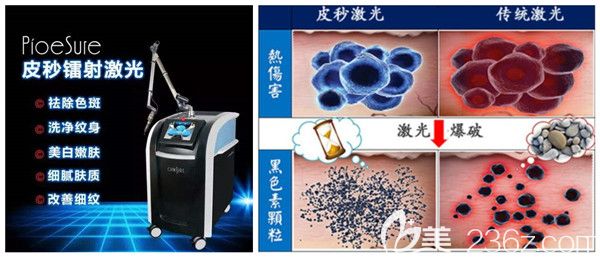 分享皮秒激光去除老年斑的原理