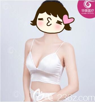 隆胸假體形狀如何選？糾結(jié)很久后我選擇了傲諾拉水滴假體豐胸價(jià)格合適