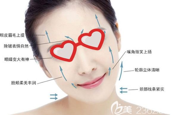 面部線雕改善的部位和效果