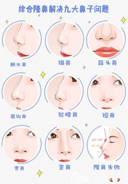 鼻綜合可以解決的鼻部類型