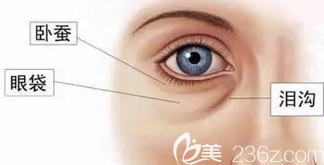 臥蠶眼袋和淚溝的區(qū)別