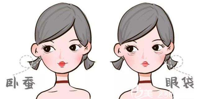 眼袋變漂亮的臥蠶