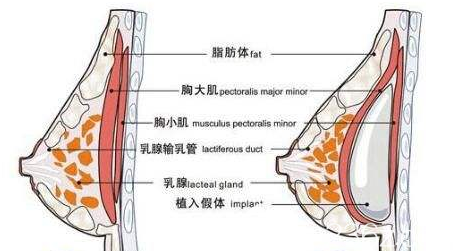 乳腺和脂肪在豐胸后在乳房里面的排布