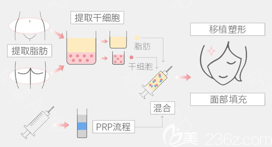 佛山華美面部脂肪填充流程圖 佛山華美面部脂肪填充流程圖