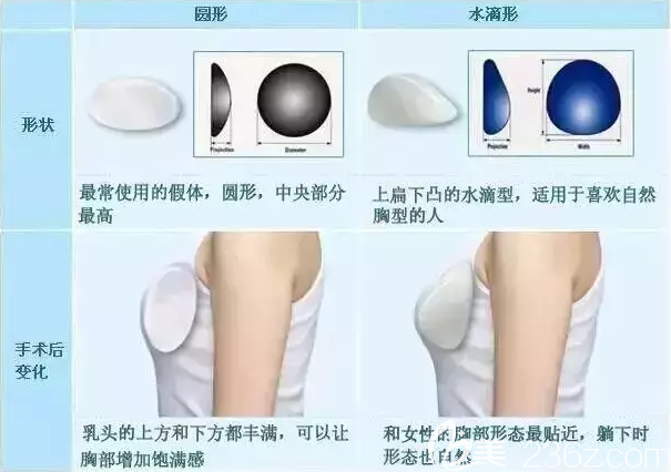水滴形和圓形假體術(shù)后變化對比