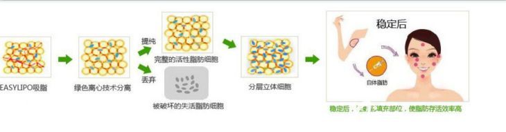 自體脂肪和玻尿酸填充的區(qū)別