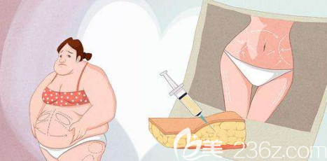 吸脂前后對比照