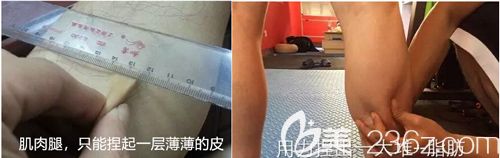 肌肉腿和脂肪型腿的不同區(qū)別