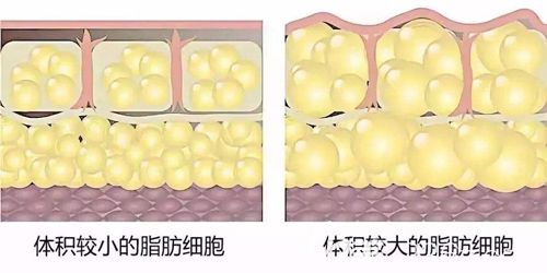 體積較小的脂肪細(xì)胞以及體積增大的脂肪細(xì)胞