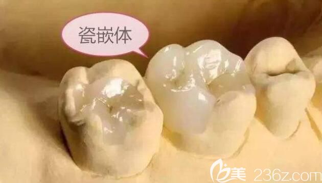 徐路路口腔知識(shí)科普 徐路路口腔知識(shí)科普