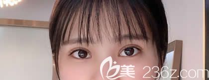 朋友都說(shuō)我在西寧康華醫(yī)院做的全切雙眼皮恢復(fù)神速，現(xiàn)在把術(shù)后快速恢復(fù)技巧告訴大家